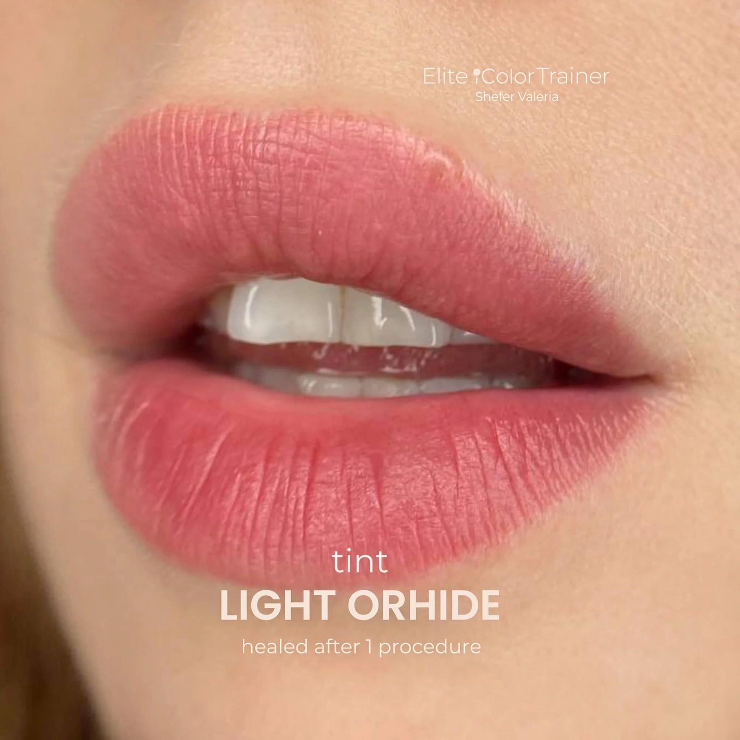 iCOLOR | ORHIDE SET iCOLOR