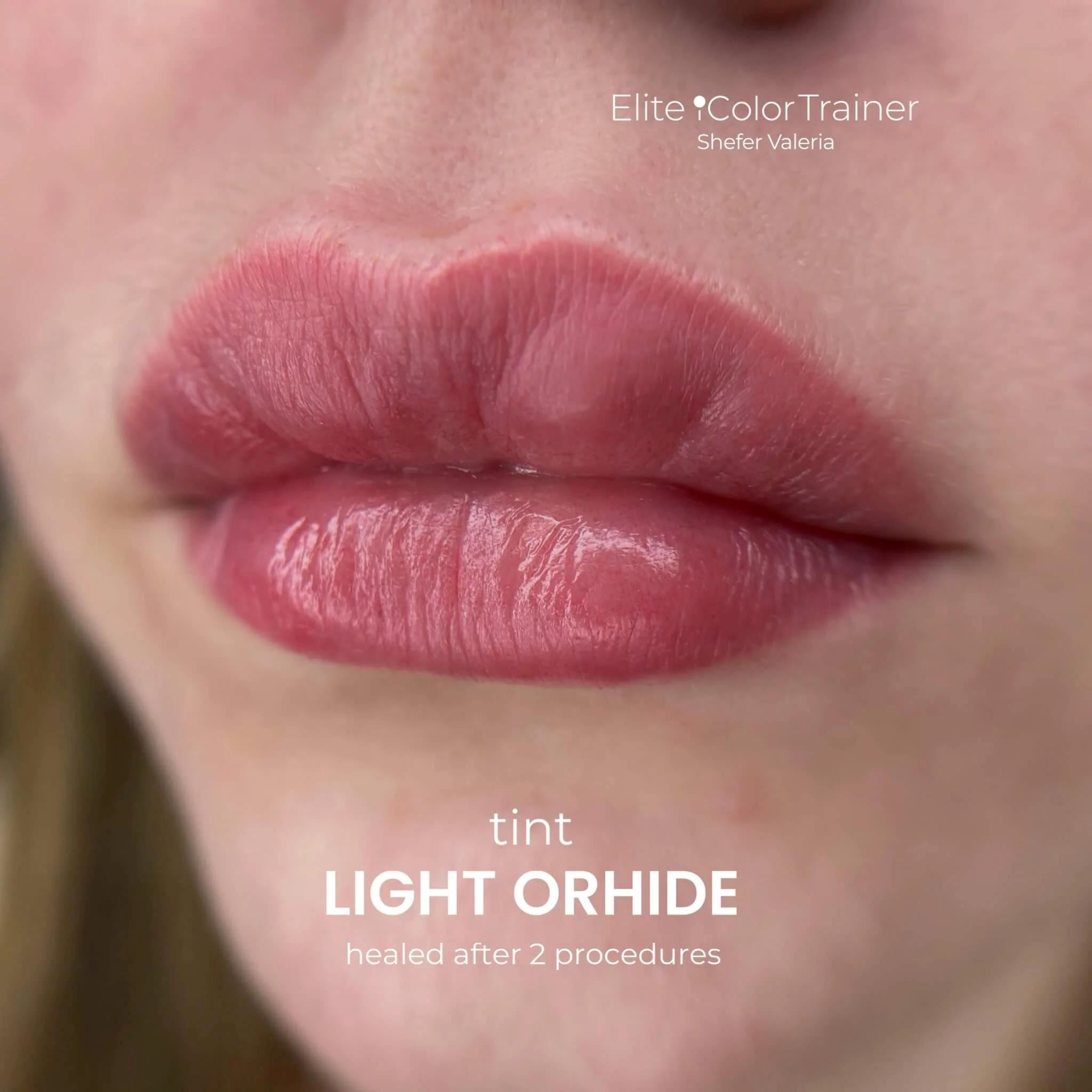 iCOLOR | ORHIDE SET iCOLOR